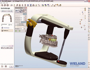 CAD/CAM-система 