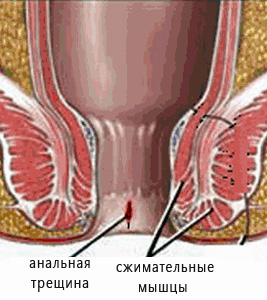 диагностика заболевания 